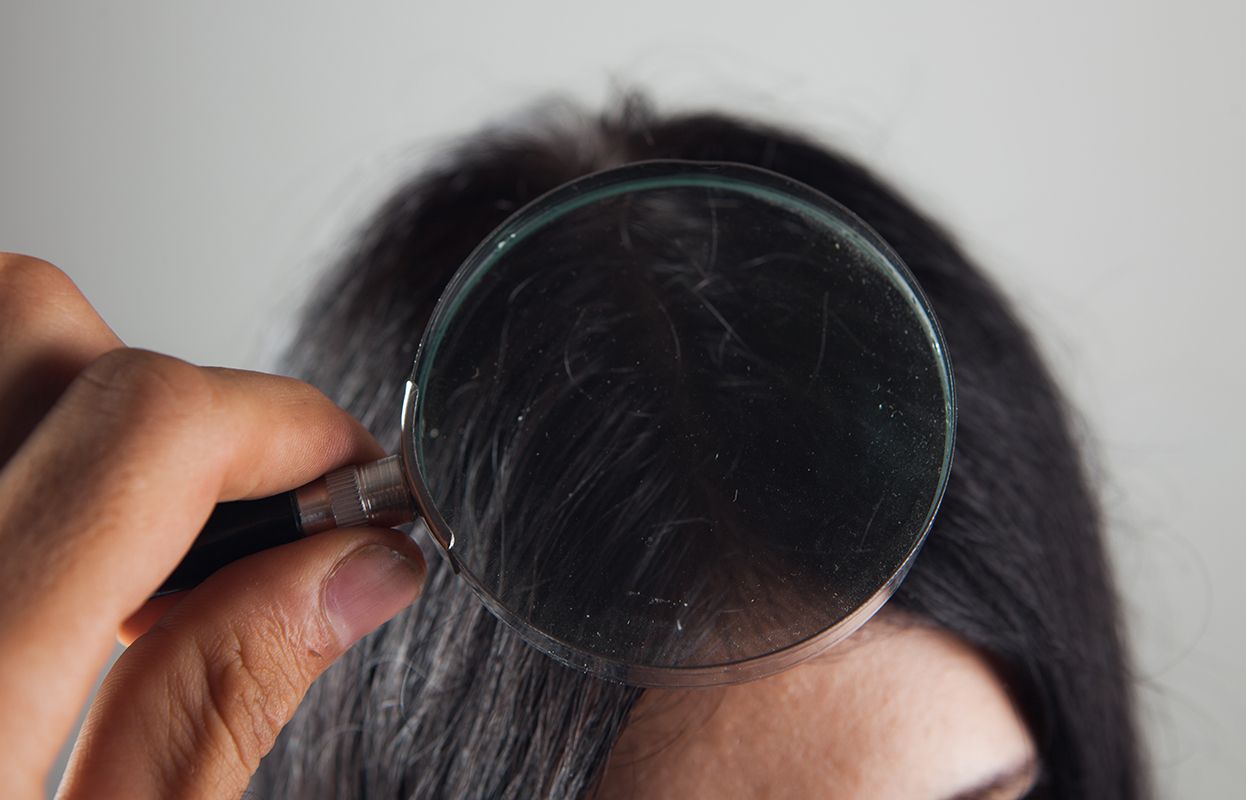 A magnifying glass over scalp and hair