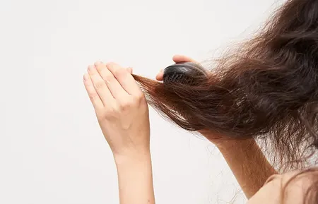 Hair Loss due Hormonal Imbalance