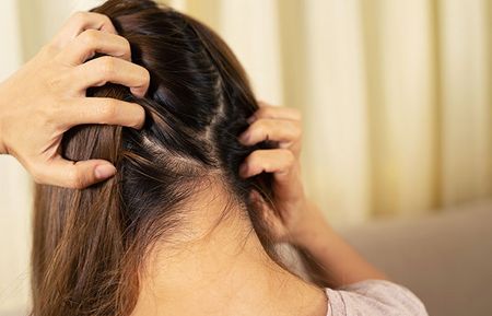 Girl with Itchy Scalp