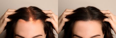 best hair oil for hair growth