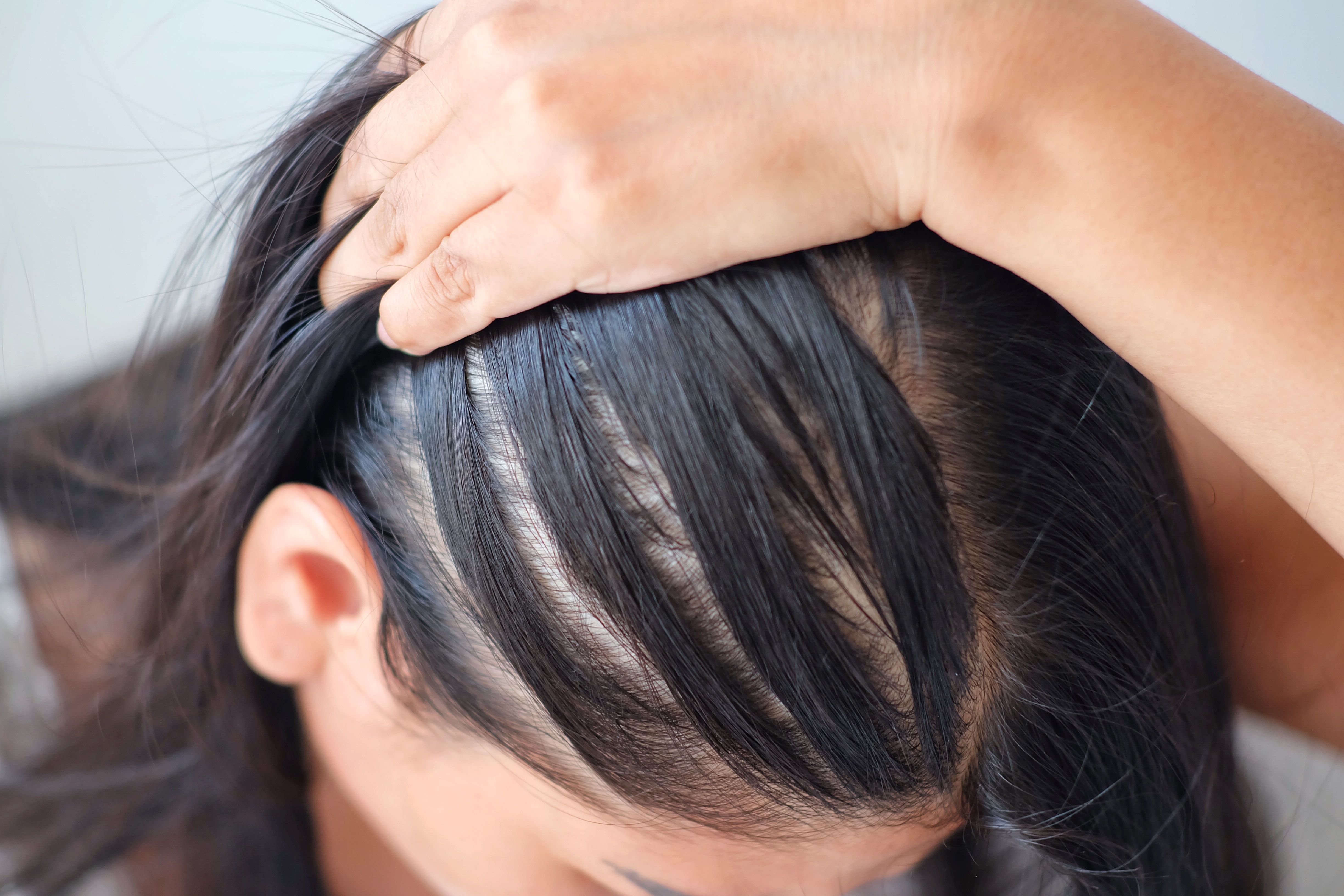 Reasons for Thinning Hair