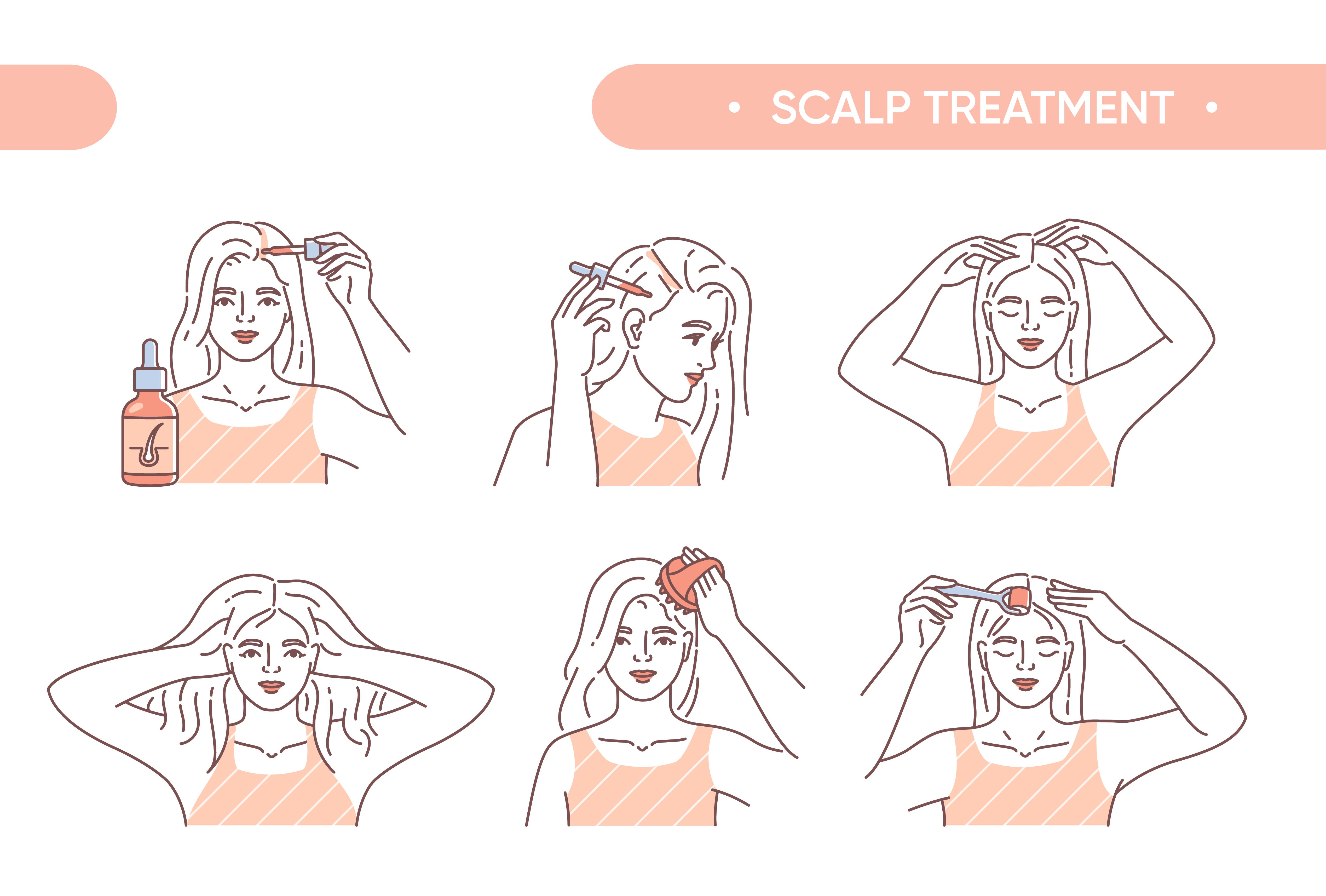 Steps to treat dandruff