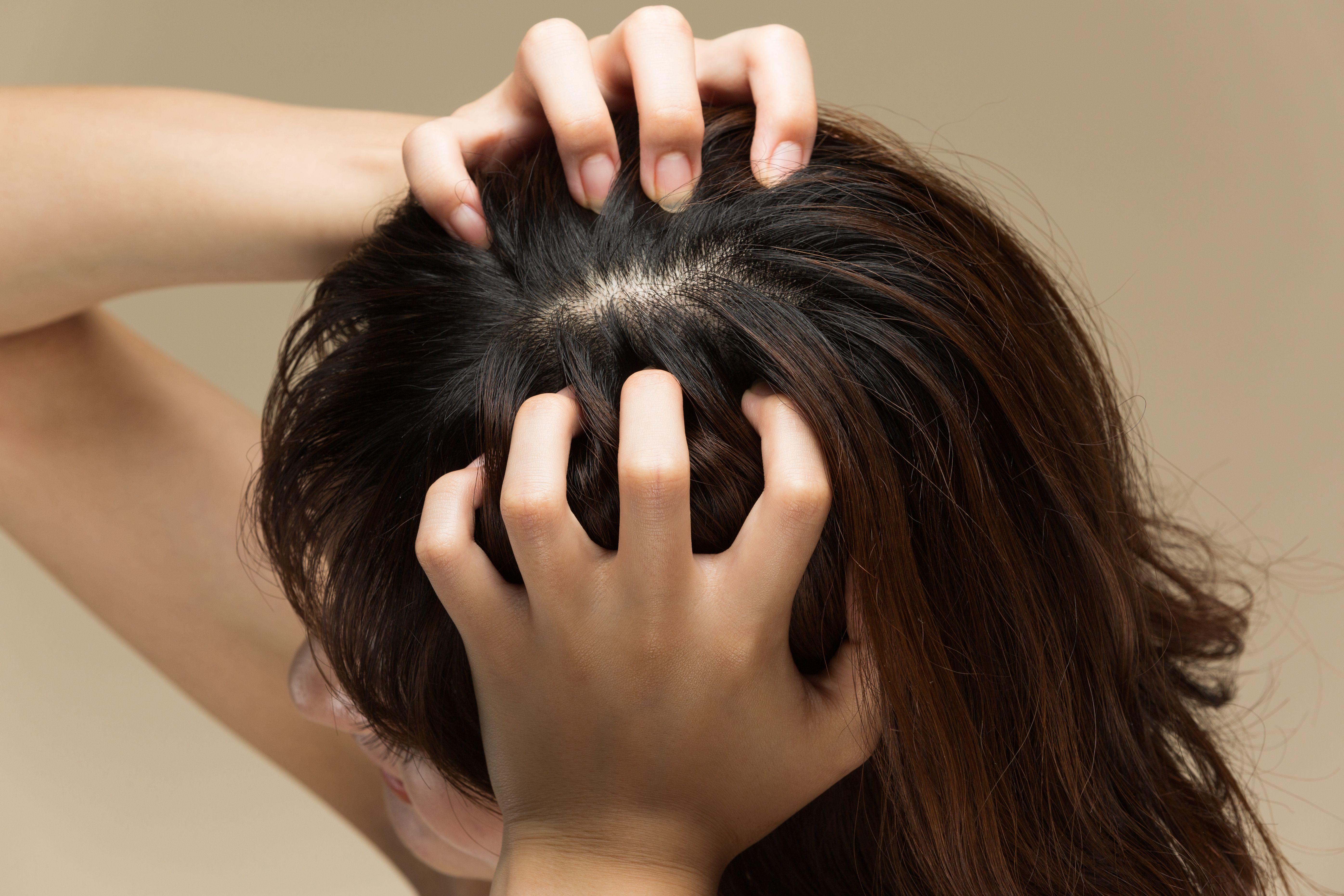 Girl with scalp Infection