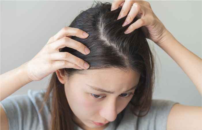 Women showing Hair Scalp