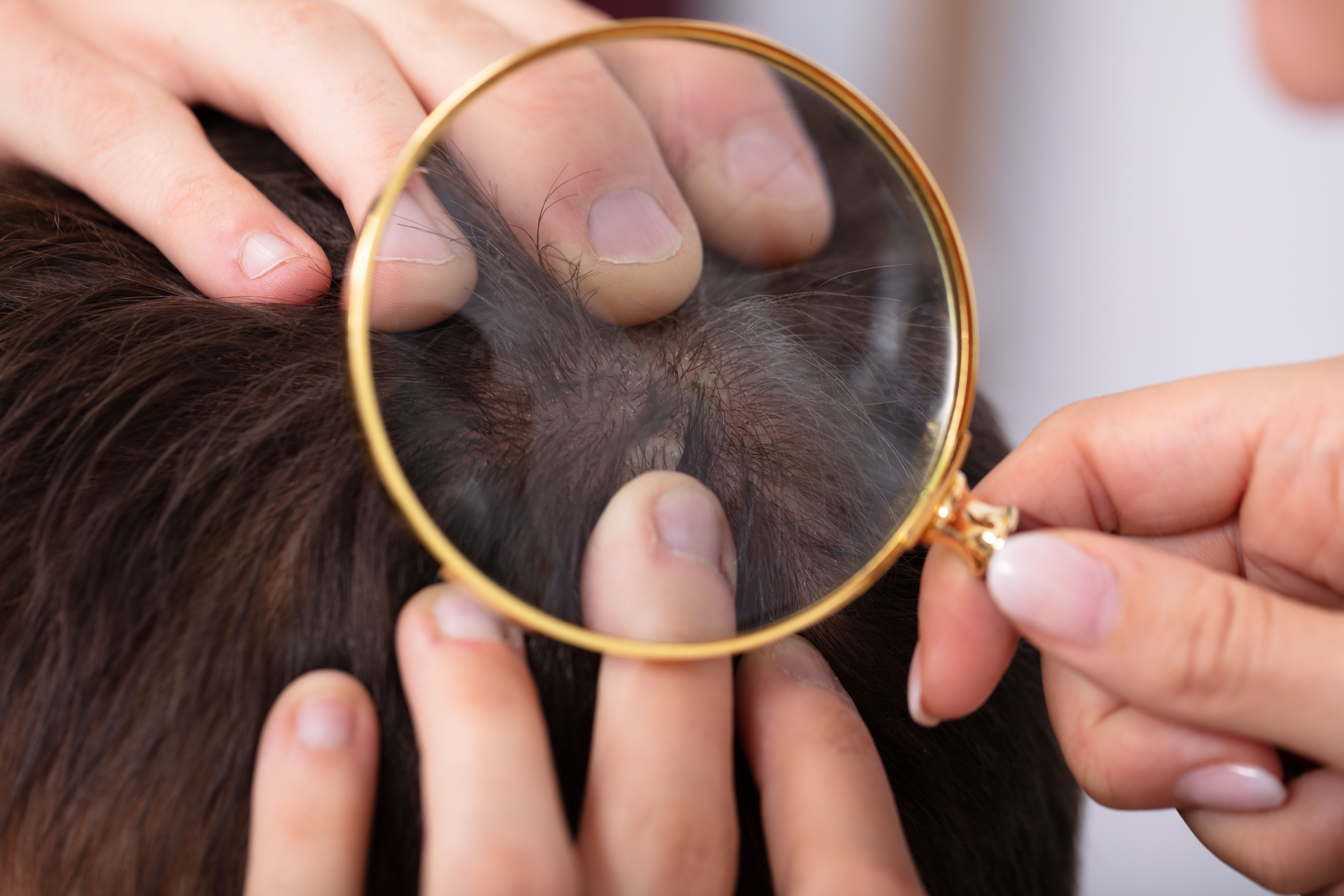 Medical help for scalp and hair concerns